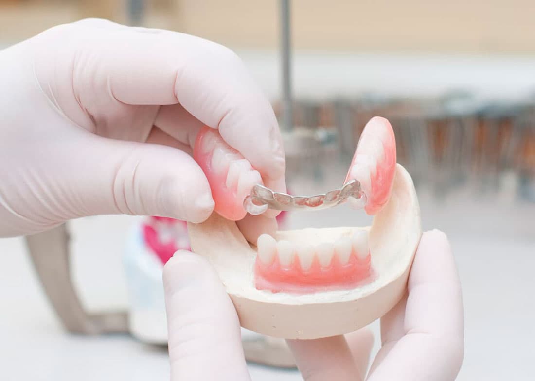 Prótesis dental removible en A Coruña