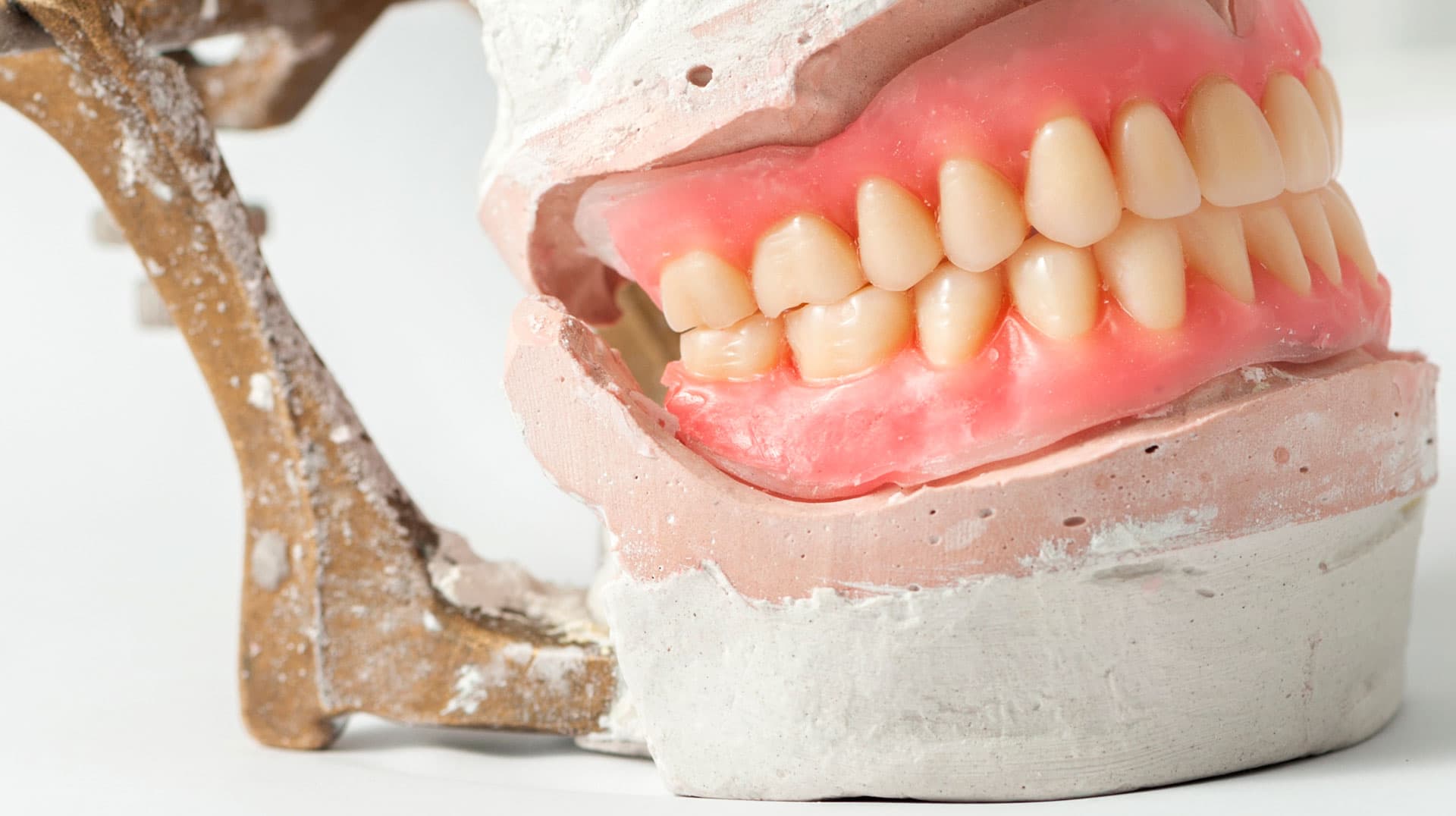 Contactar con laboratorio de prótesis dentales